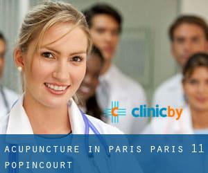 Acupuncture in Paris (Paris 11 Popincourt)